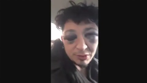 Separaron a los policías de Santa Cruz que molieron a palos a un conocido músico: "La intención fue matarme"